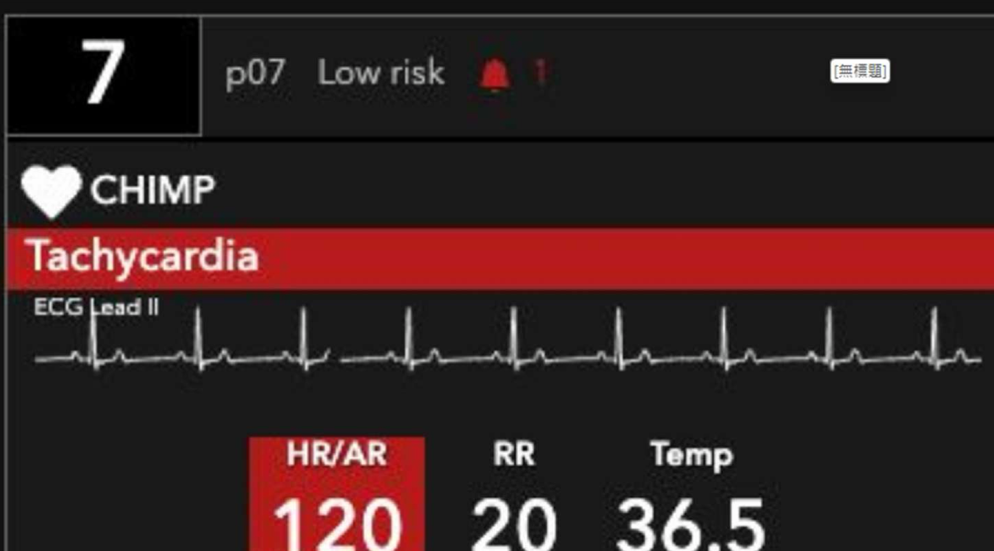 CHIMP Alert Notification interface highlighting a tachycardia alert
